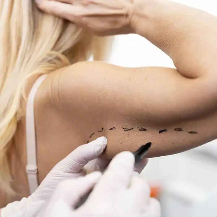 Plastic Surgery in Dubai